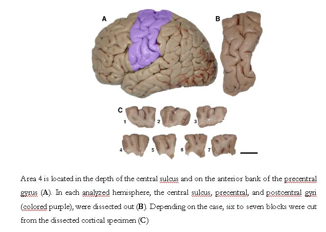 anterior central gyrus
