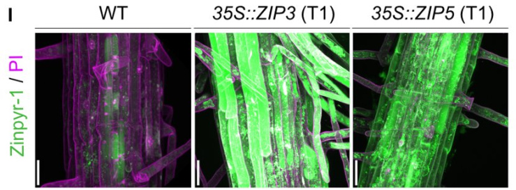 We identified four new AtZIP transporters localized at the root outer domain which contribute to metals acquisition from the soil!