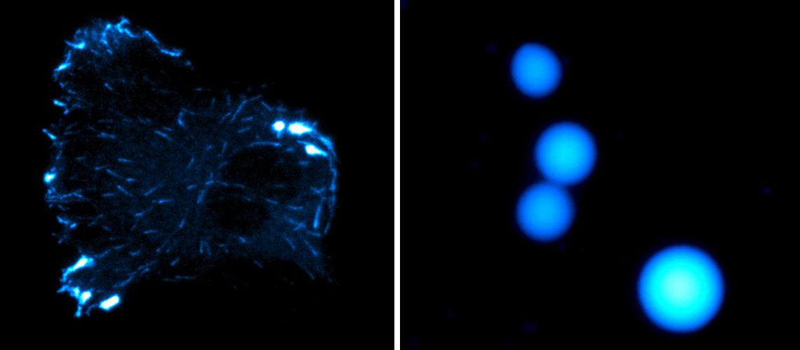 Cell and condensates.png