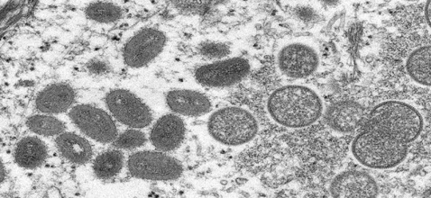 c0524490-monkeypox_virus_particles_tem_1WEB_A.jpg