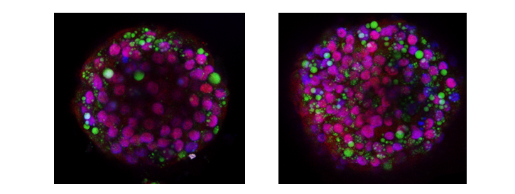 FOTI_liver_organoids_mi149.png